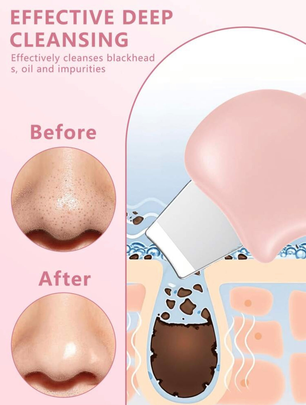 Skin Scrubber Face Scraper Tool Blackhead Remover